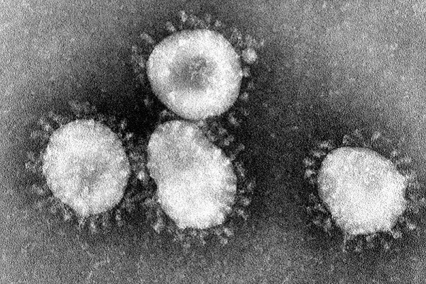 800px-Coronaviruses_004_lores.jpg